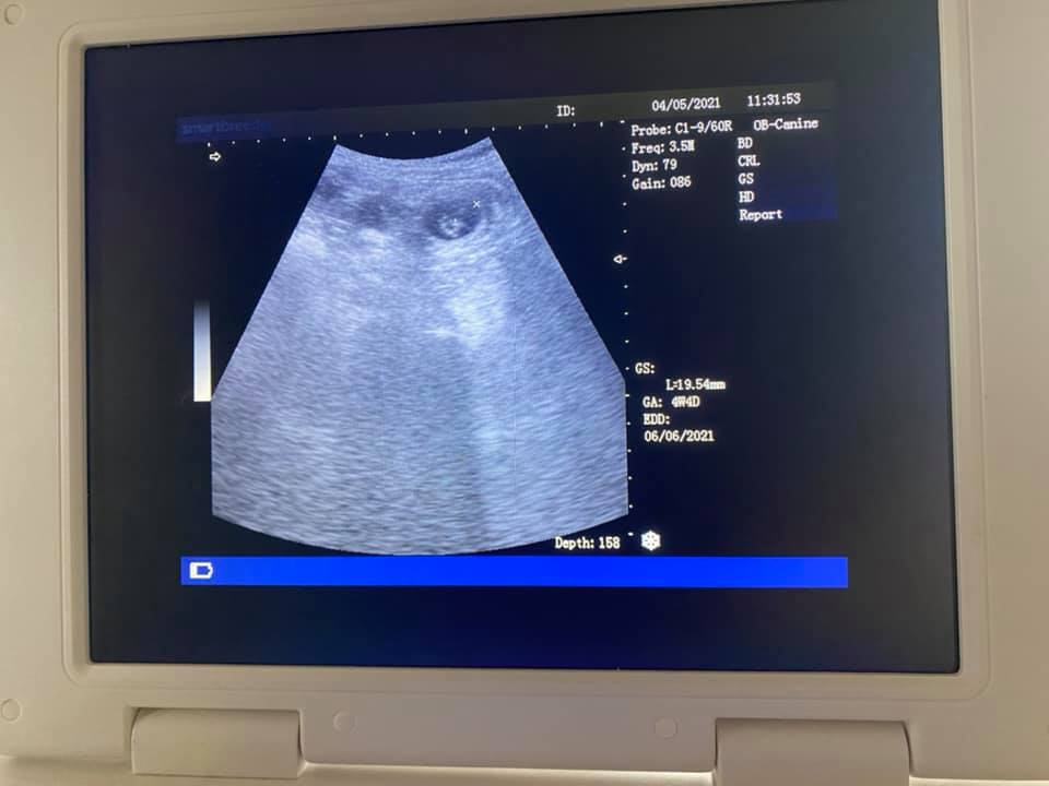 Ultrasound Scans