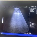 Confirmation ultrasound Scan Preston