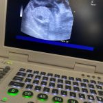 Ultrasound Scan Euxton