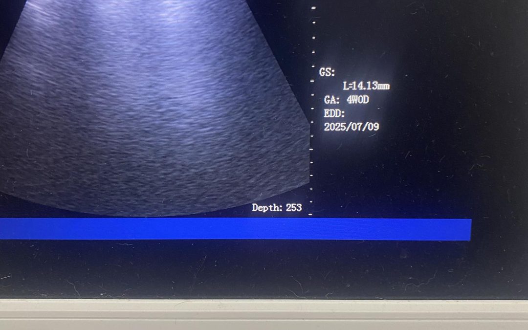 Dog Ultrasound Heysham