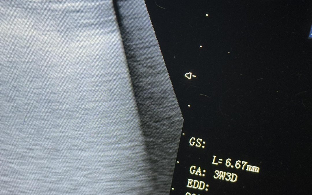 Mobile Dog Ultrasound Leyland