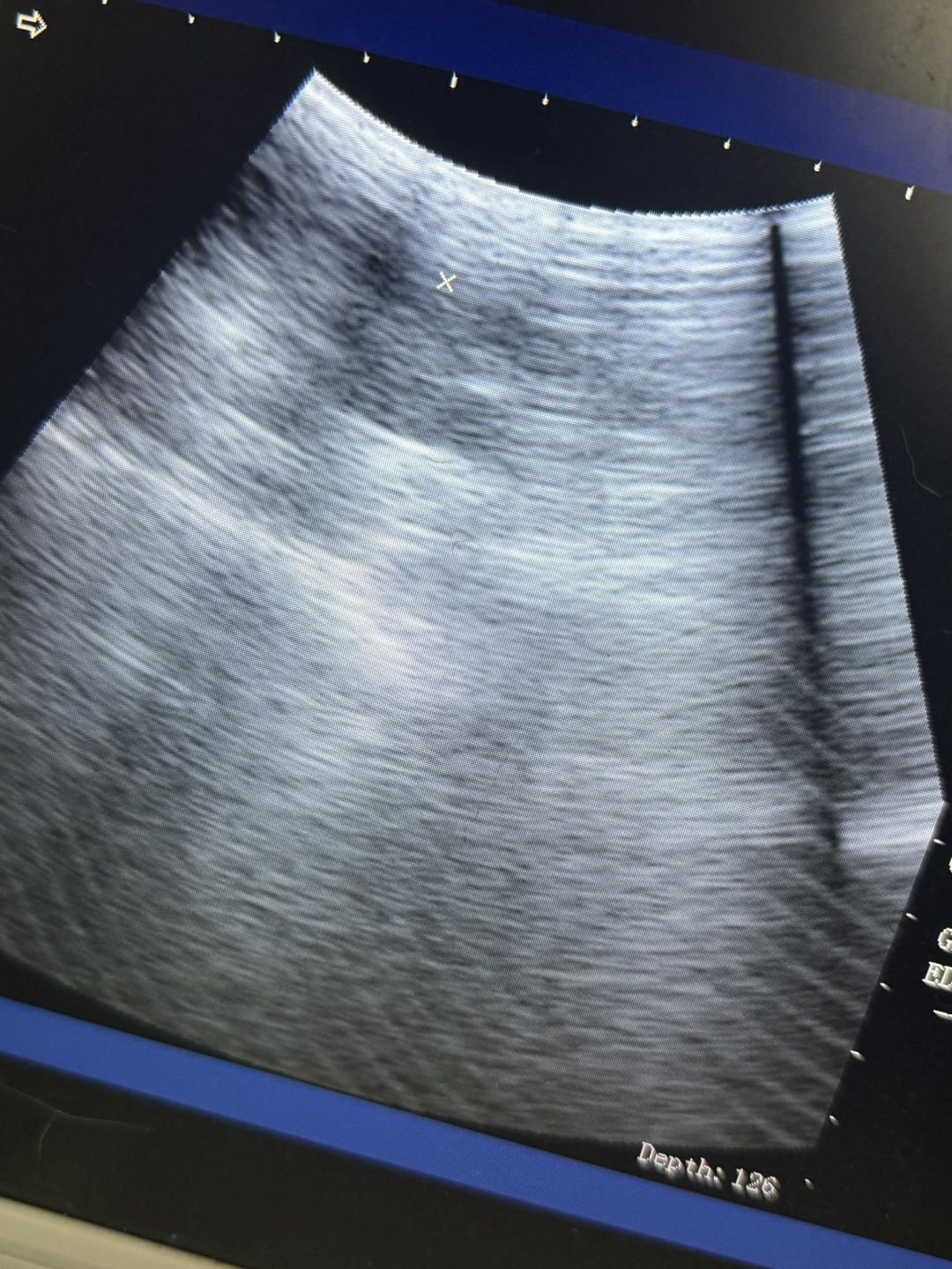 Preston Mobile Cat Ultrasound