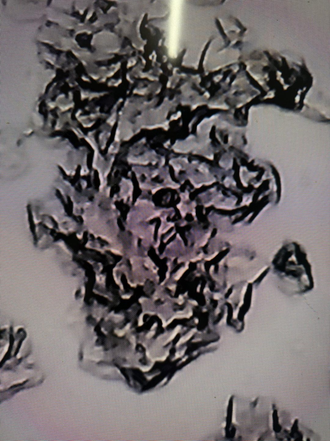 Cytology swabs Blackpool