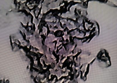 Cytology swabs Blackpool