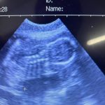 Mobile Dog Ultrasound Penwortham