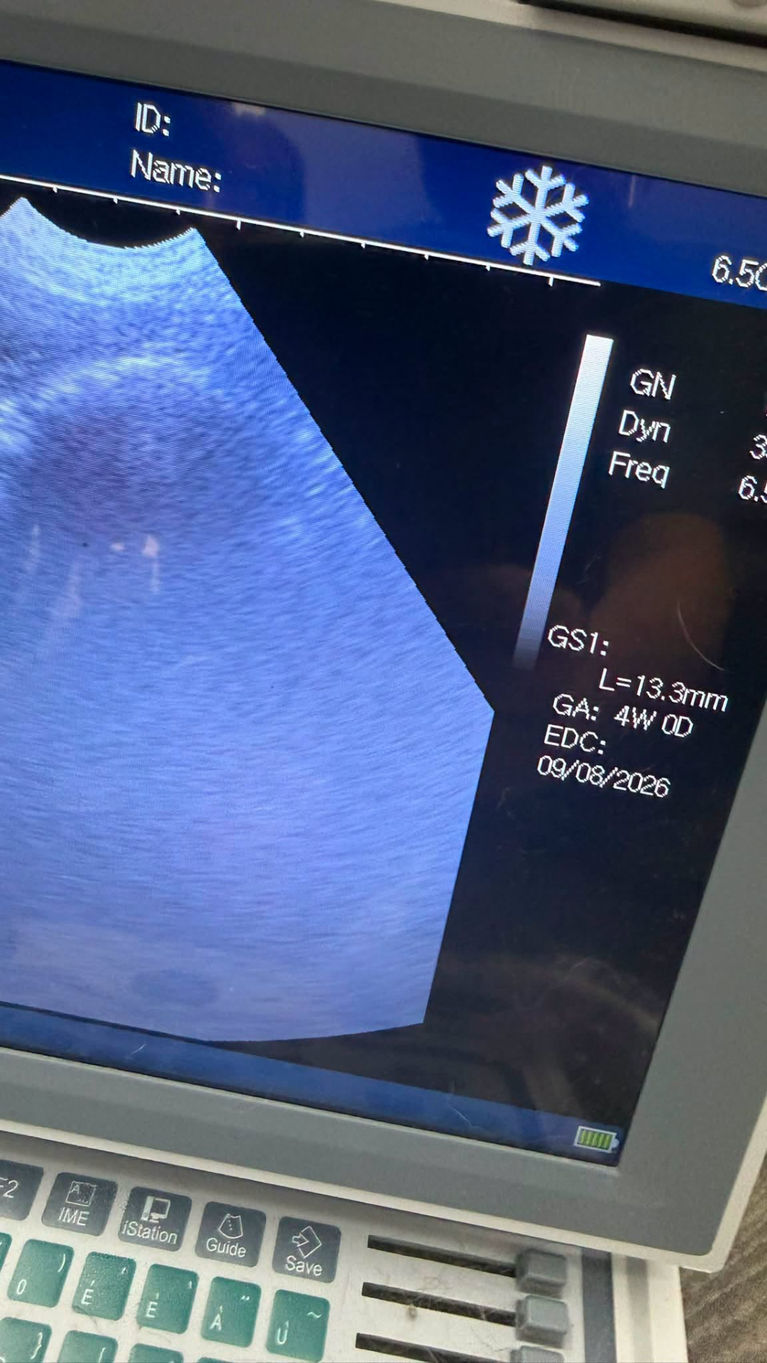 Dog Ultrasound Cockerham