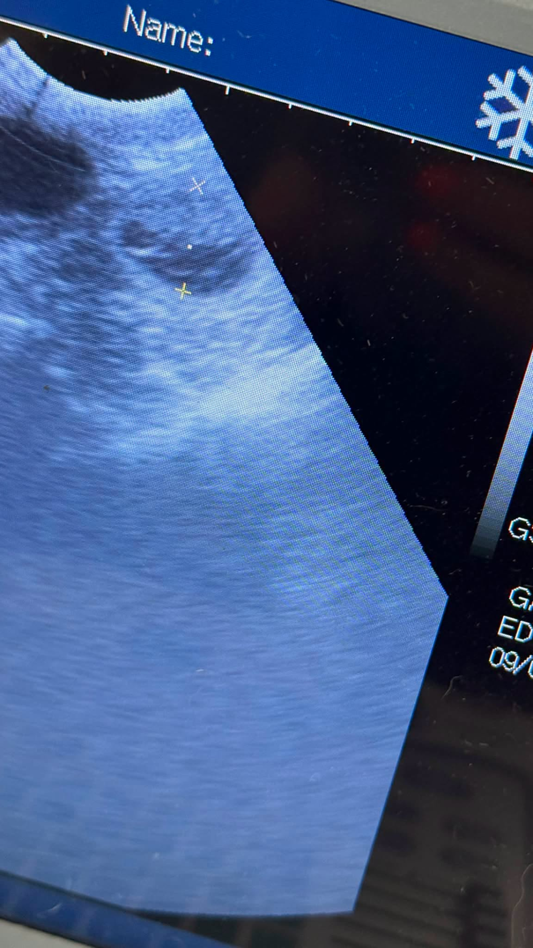 Cat Ultrasound Scan Preston